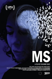 MS