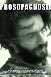Prosopagnosia