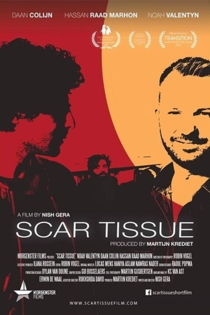 Scar Tissue