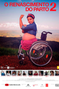 O Renascimento do Parto 2
