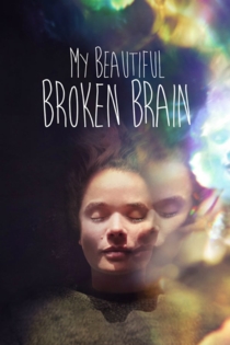 My Beautiful Broken Brain