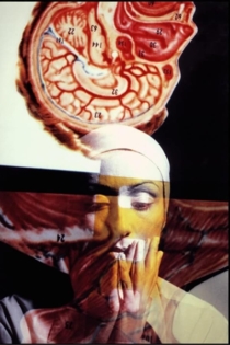 Arteria magna in dolore laterali