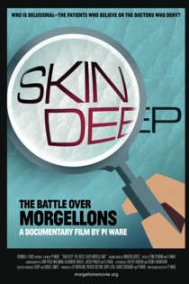 Skin Deep: The Battle Over Morgellons