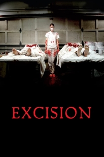 Excision