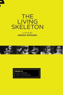 The Living Skeleton