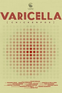Varicella