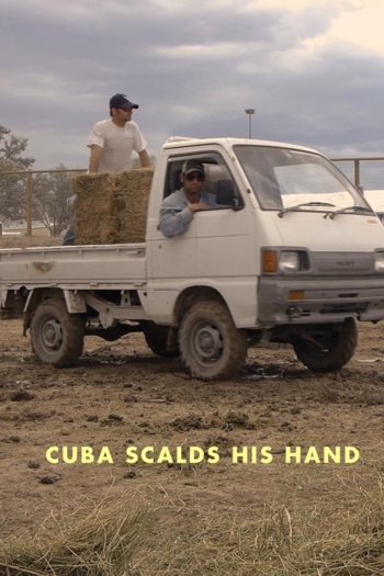 Cuba Scalds His Hand