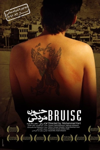 Bruise