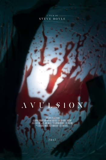 Avulsion