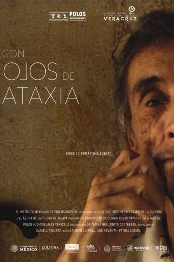 Con ojos de ataxia