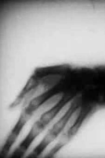 Roentgenfilm III and IV