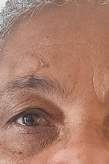 Alternativas Felizes Para Quando o Sol Não Vem