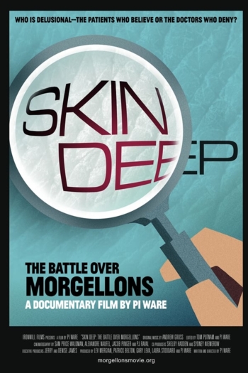 Skin Deep: The Battle Over Morgellons