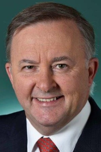 Actor Anthony Albanese